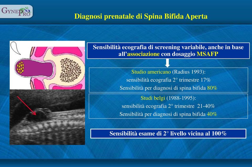 17% Sensibilità per diagnosi di spina bifida 80% Studi belgi (1988-1995): sensibilità ecografia 2