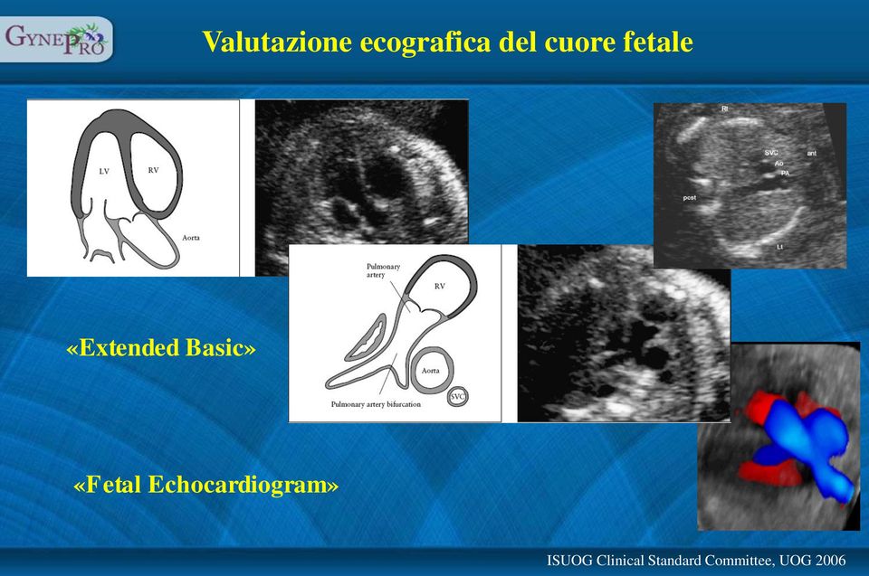 «Fetal Echocardiogram» ISUOG