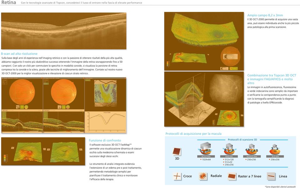 B-scan ad alta risoluzione Sulla base degli anni di esperienza nell'imaging retinico e con la passione di ottenere risultati della più alta qualità, abbiamo raggiunto il nostro più sbalorditivo