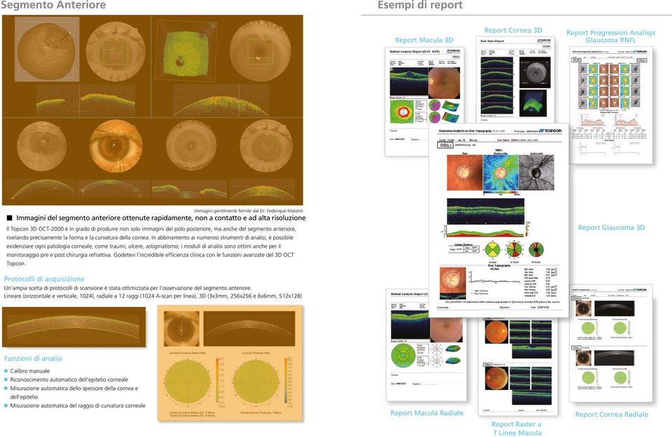 anche del segmento anteriore, rivelando precisamente la forma e la curvatura della cornea.
