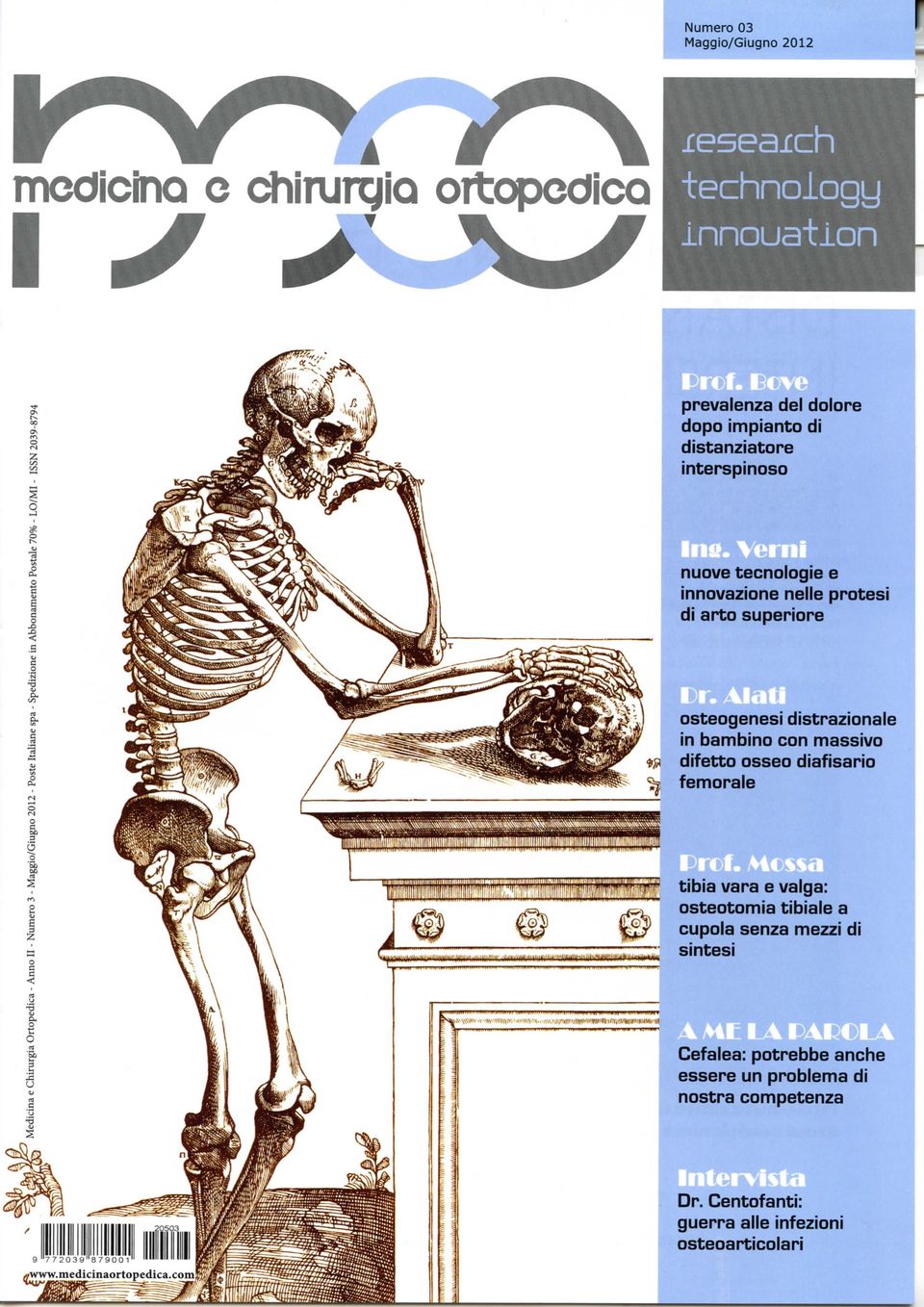 distrazionale in bambino con massivo difetto osseo diafisario femorale tibia vara e valga: osteotomia tibiale a cupola