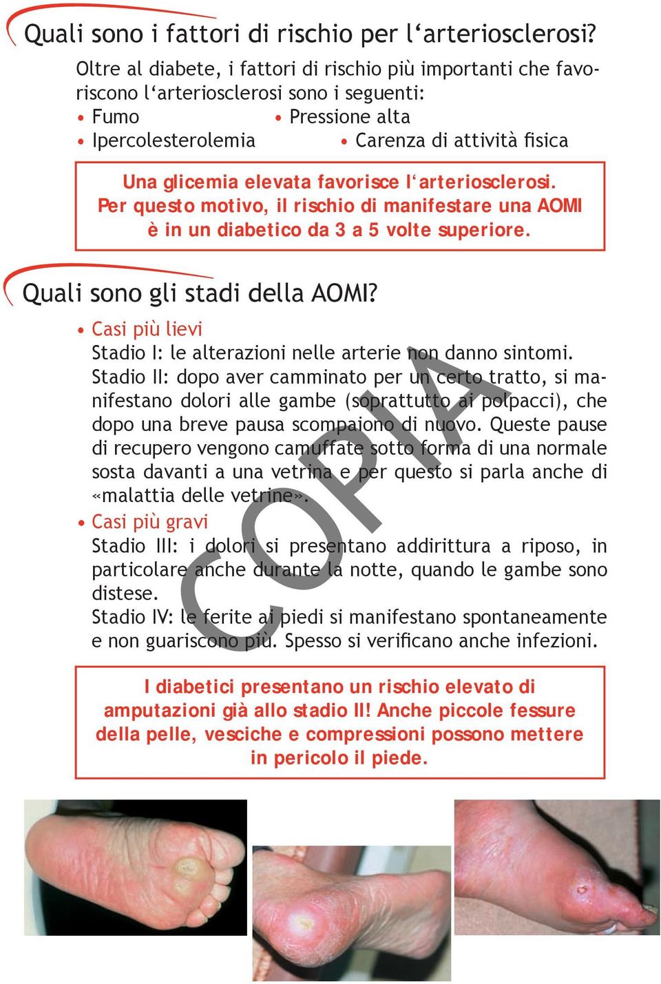 favorisce l arteriosclerosi. Per questo motivo, il rischio di manifestare una AOMI è in un diabetico da 3 a 5 volte superiore. Quali sono gli stadi della AOMI?