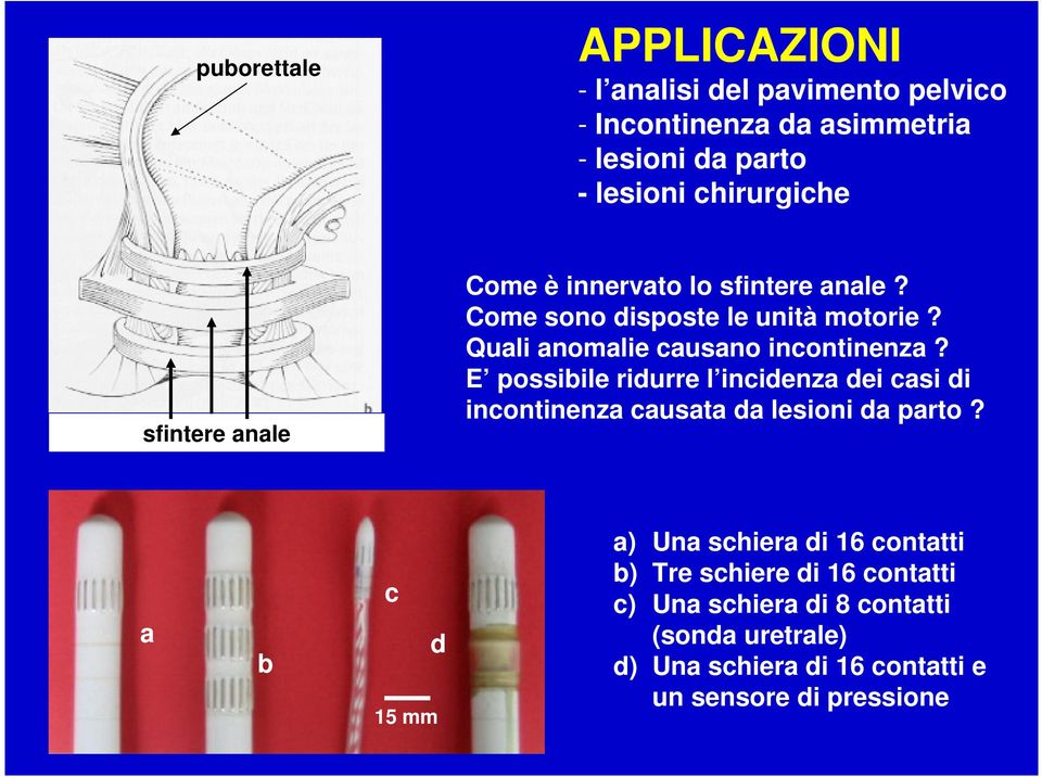 E possibile ridurre l incidenza dei casi di incontinenza causata da lesioni da parto?