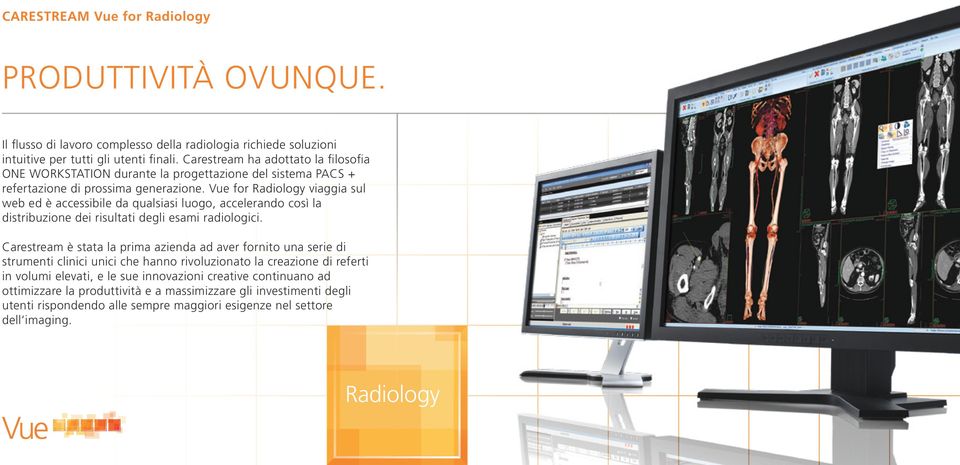 Vue for Radiology viaggia sul web ed è accessibile da qualsiasi luogo, accelerando così la distribuzione dei risultati degli esami radiologici.