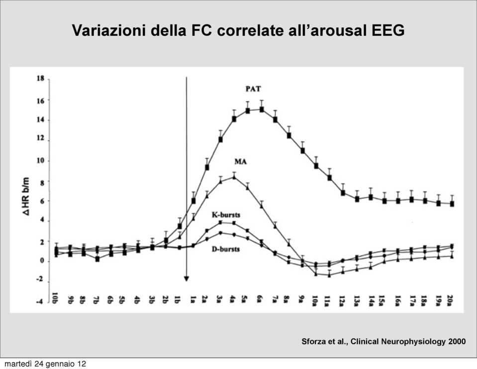 EEG Sforza et al.