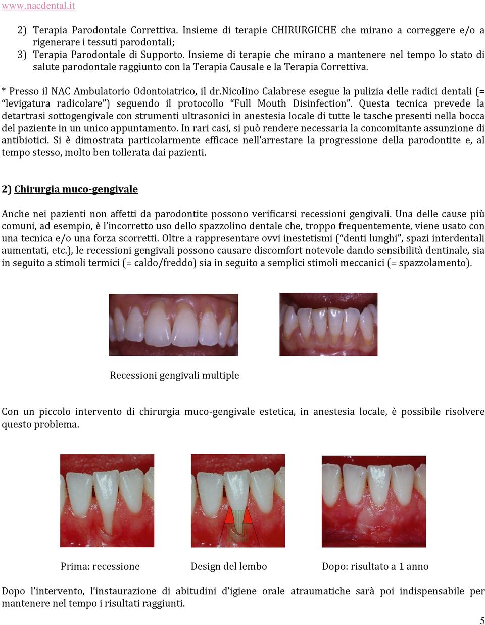 nicolino Calabrese esegue la pulizia delle radici dentali (= levigatura radicolare ) seguendo il protocollo Full Mouth Disinfection.