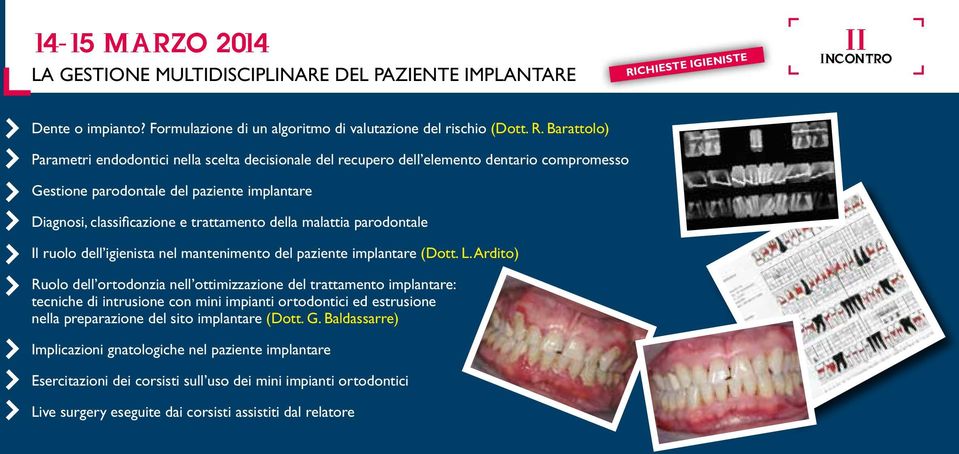 malattia parodontale Il ruolo dell igienista nel mantenimento del paziente implantare (Dott. L.