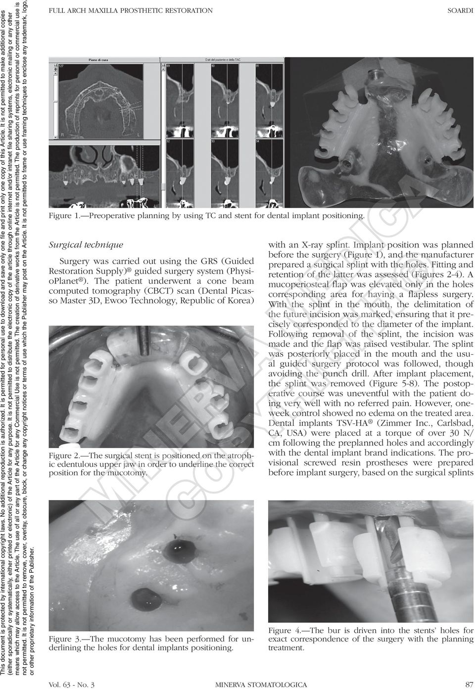 The patient underwent a cone beam computed tomography (CBCT) scan (Dental Picasso Master 3D, Ewoo Technology, Republic of Korea) Figure 2.