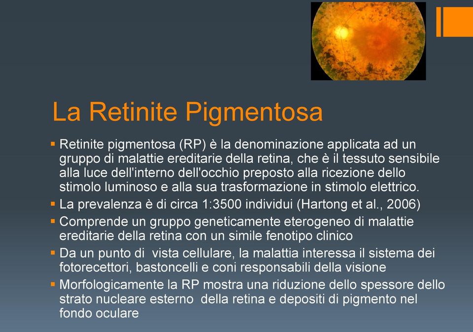 , 2006) Comprende un gruppo geneticamente eterogeneo di malattie ereditarie della retina con un simile fenotipo clinico Da un punto di vista cellulare, la malattia interessa il