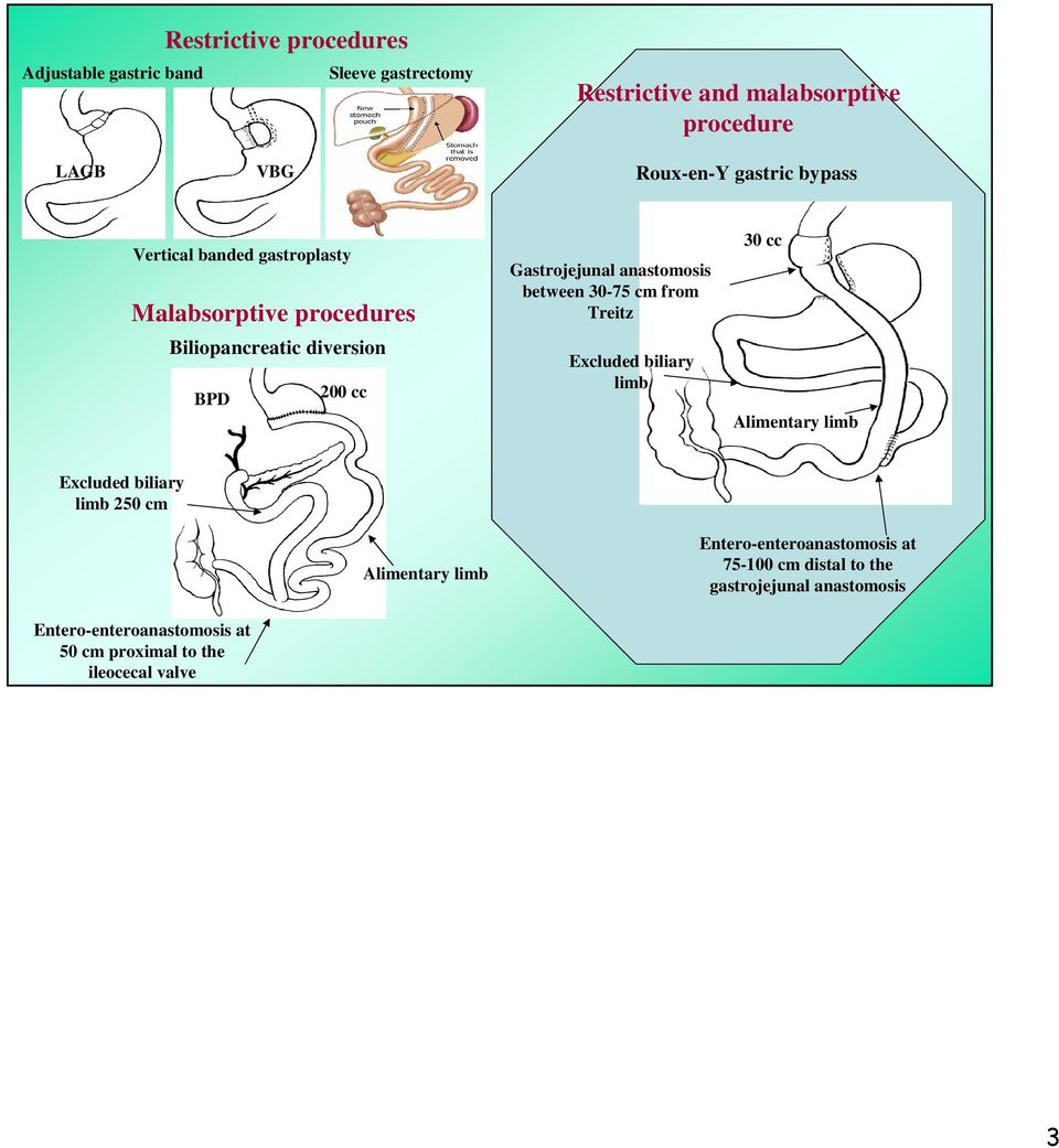 between 3-75 cm from Treitz Excluded biliary limb 3 cc Alimentary limb Excluded biliary limb 5 cm Alimentary limb