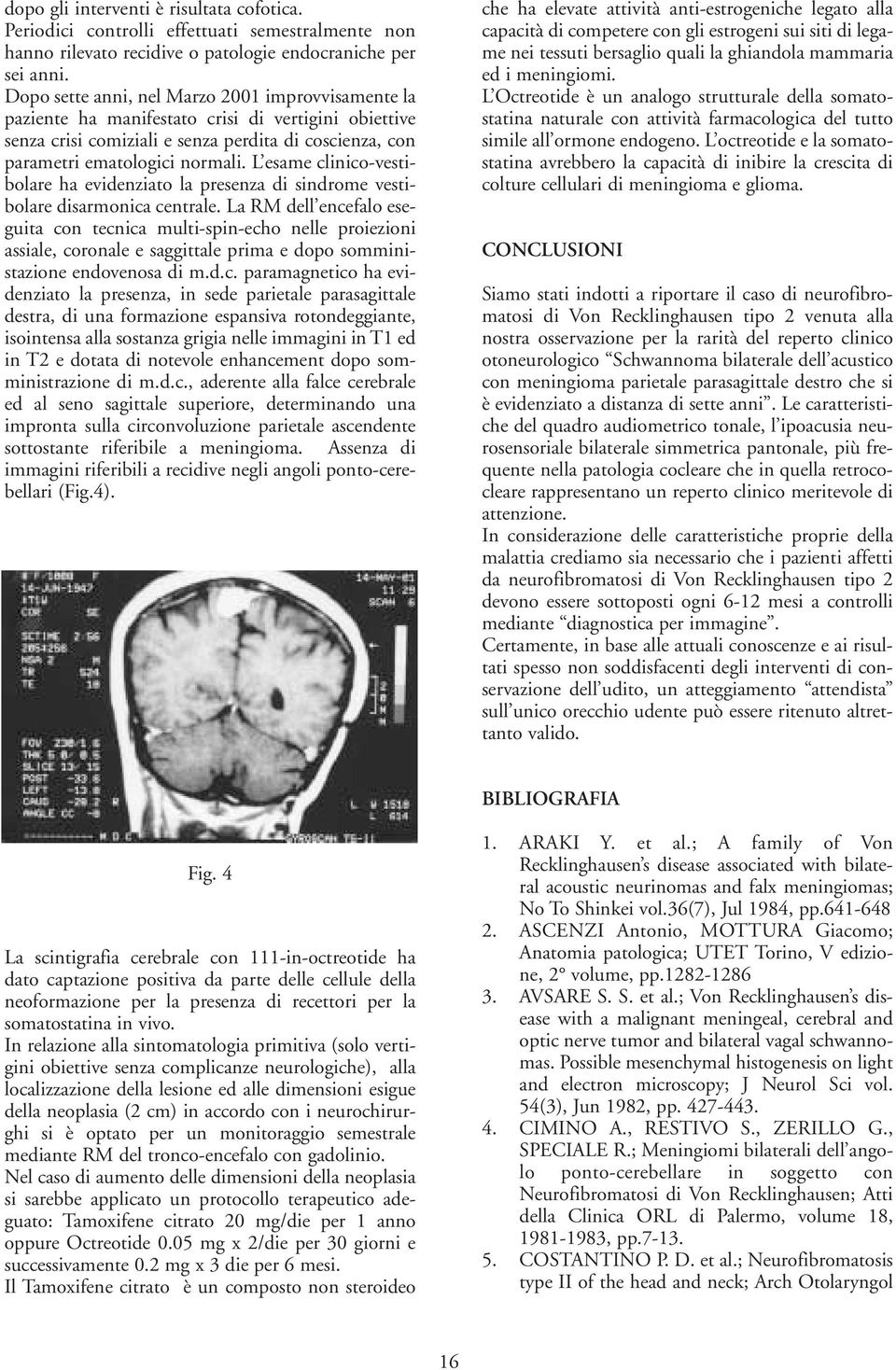 L esame clinico-vestibolare ha evidenziato la presenza di sindrome vestibolare disarmonica centrale.