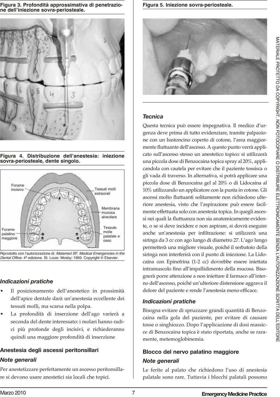 Forame incisivo Forame palatino maggiore Indicazioni pratiche Tessuti molli extraorali Membrana mucosa alveolare Tessuto molle palatale e osso Riprodotto con l autorizzazione di: Malamed SF.