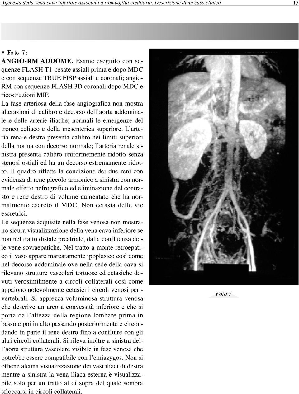 La fase arteriosa della fase angiografica non mostra alterazioni di calibro e decorso dell aorta addominale e delle arterie iliache; normali le emergenze del tronco celiaco e della mesenterica