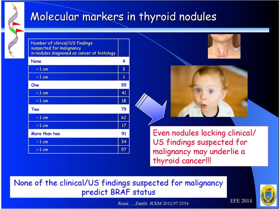 57 Even nodules lacking clinical/ US findings suspected for malignancy may underlie a thyroid cancer!