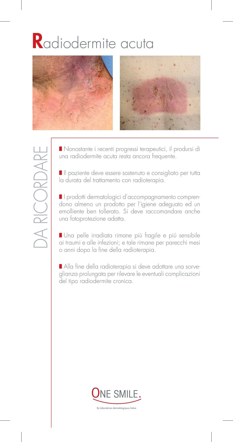 M I prodotti dermatologici d accompagnamento comprendono almeno un prodotto per l igiene adeguato ed un emolliente ben tollerato. Si deve raccomandare anche una fotoprotezione adatta.