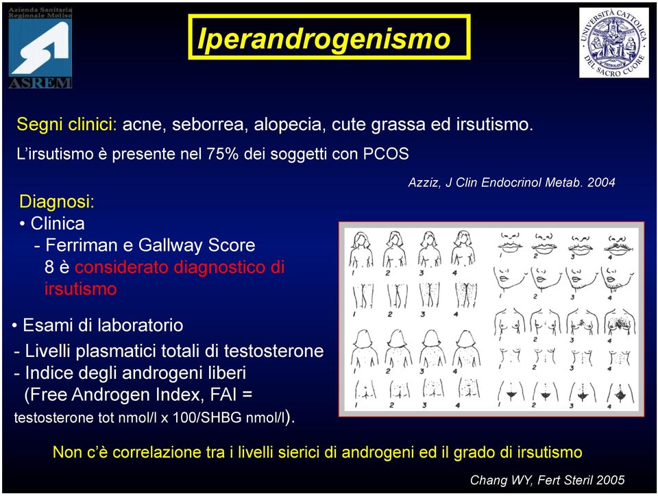 irsutismo Azziz, J Clin Endocrinol Metab.