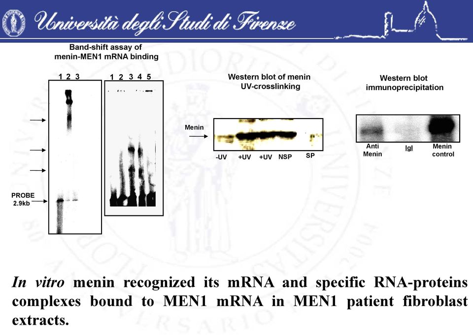 Anti Menin IgI Menin control PROBE 2.