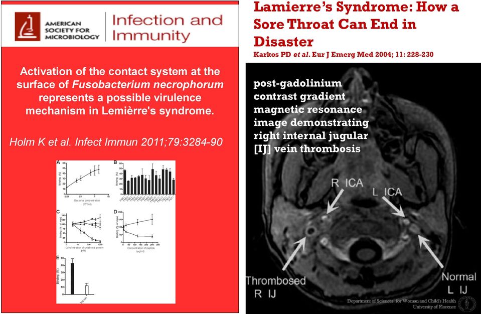 Infect Immun 2011;79:3284-90 Lamierre s Syndrome: How a Sore Throat Can End in Disaster Karkos PD et al.