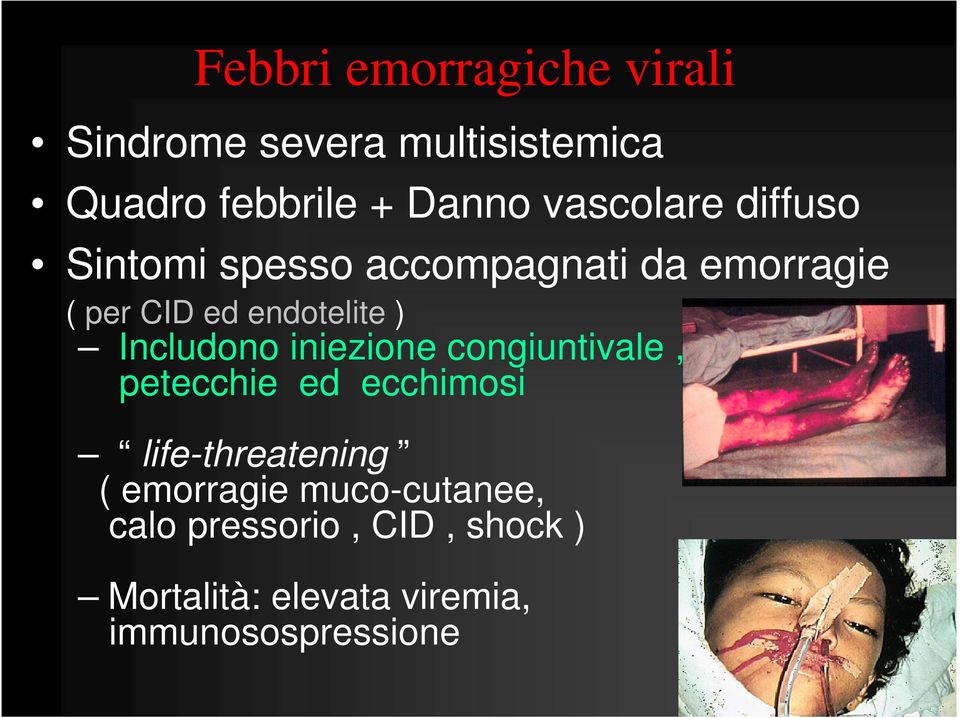 Includono iniezione congiuntivale, petecchie ed ecchimosi life-threatening (