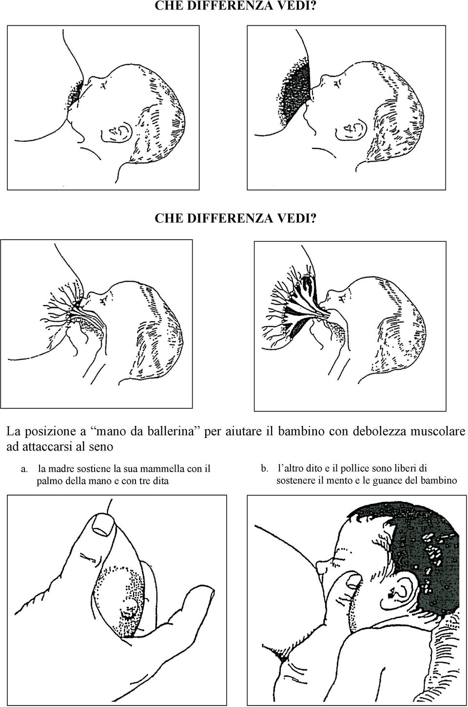 muscolare ad attaccarsi al seno a.