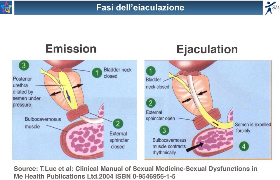 NON FREQUENTI SESSUALI NON FREQUE BASSA AUTOSTIMA BASSA AUTOSTIMA DEPRESSIONE DEPRESSIONE SCARSE TECNICHE SCARSE DI CONTROLLO TECNICHE DELL'EIACULAZIONE DI CONTROLLO TIMORE DI PERDERE TIMORE