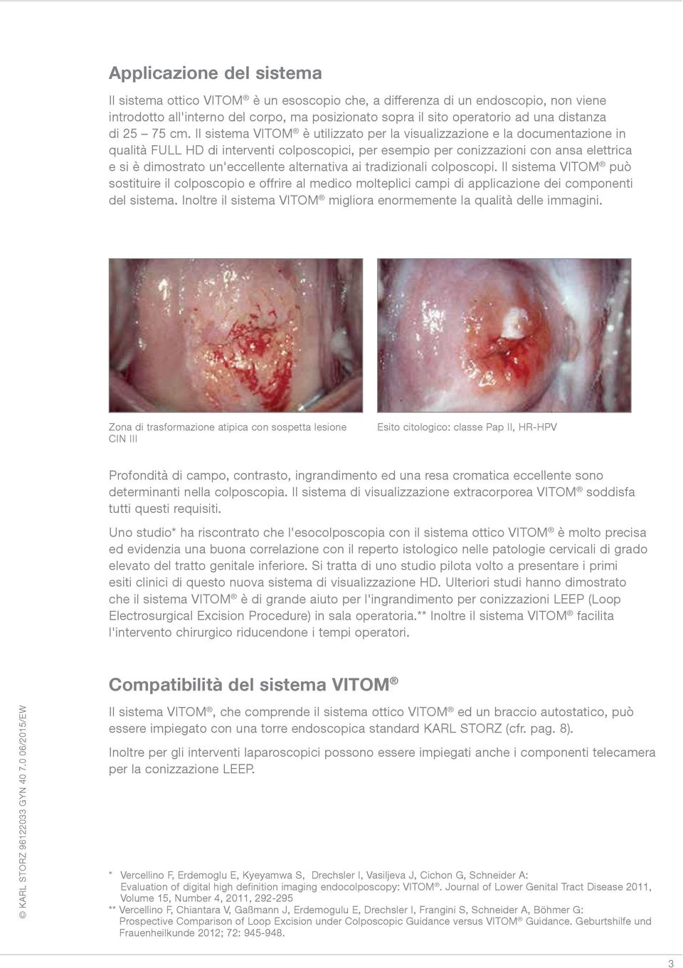 Il sistema VITOM è utilizzato per la visualizzazione e la documentazione in qualità FULL HD di interventi colposcopici, per esempio per conizzazioni con ansa elettrica e si è dimostrato un'eccellente