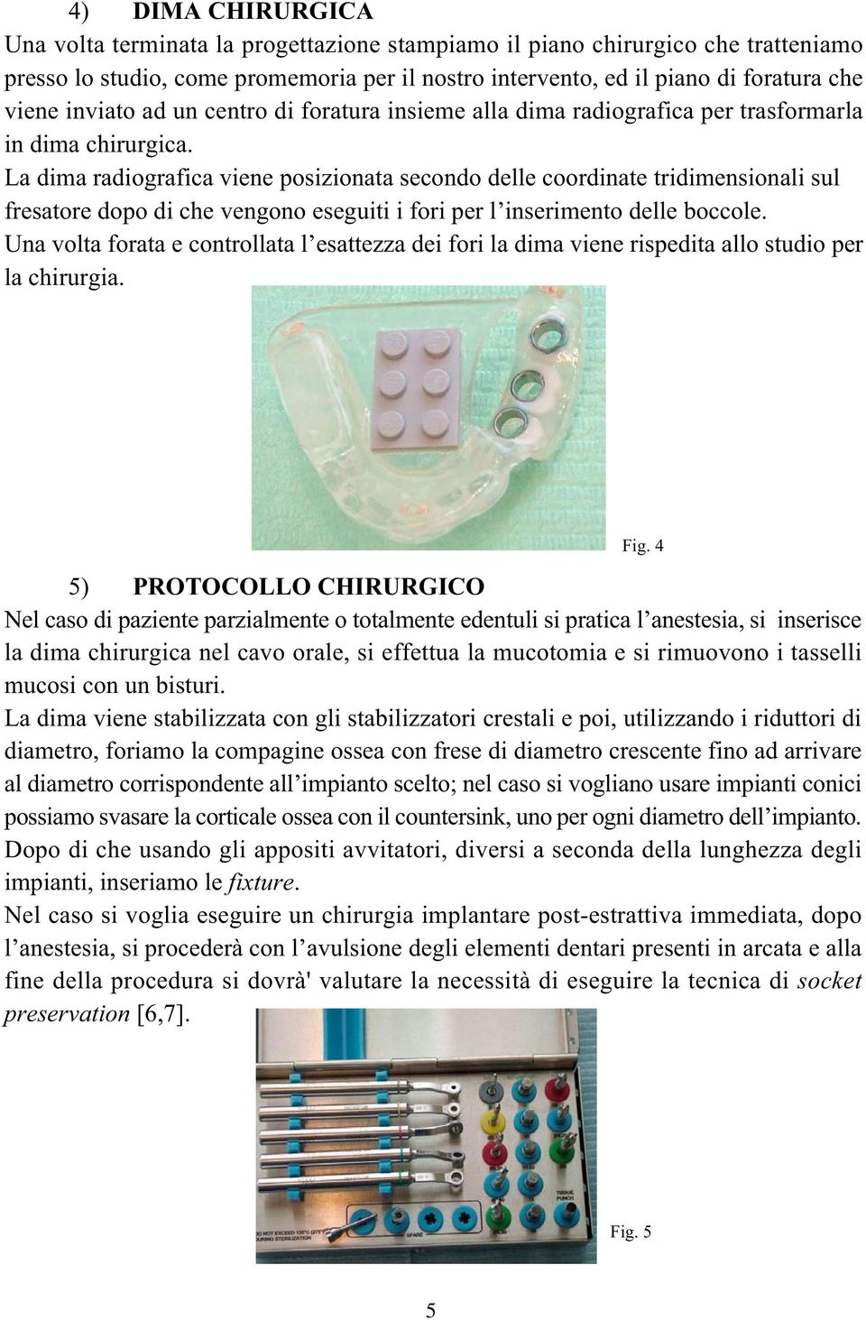 La dima radiografica viene posizionata secondo delle coordinate tridimensionali sul fresatore dopo di che vengono eseguiti i fori per l inserimento delle boccole.