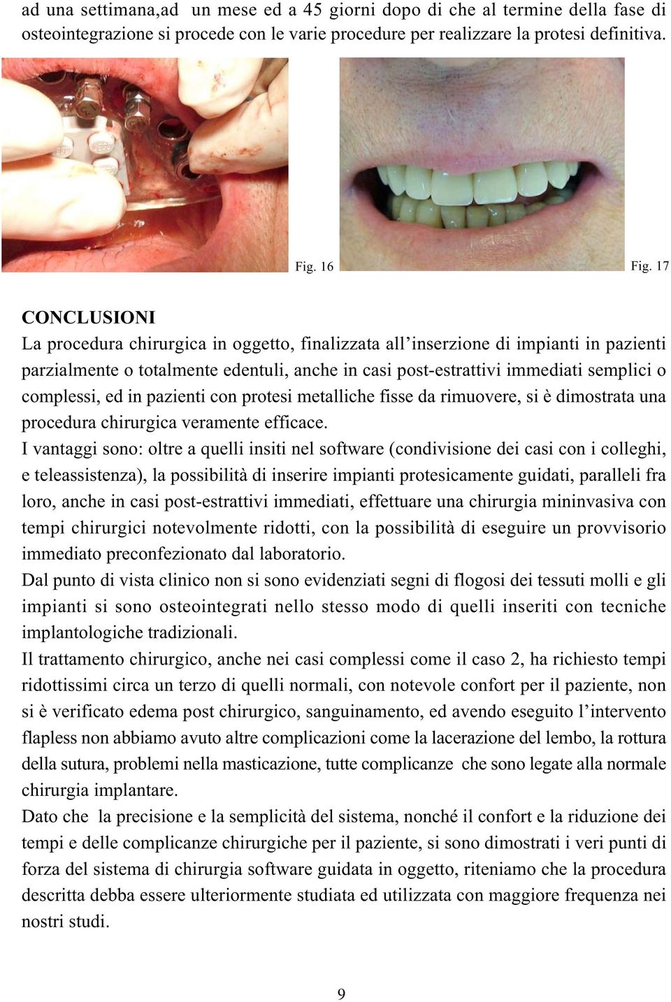 ed in pazienti con protesi metalliche fisse da rimuovere, si è dimostrata una procedura chirurgica veramente efficace.