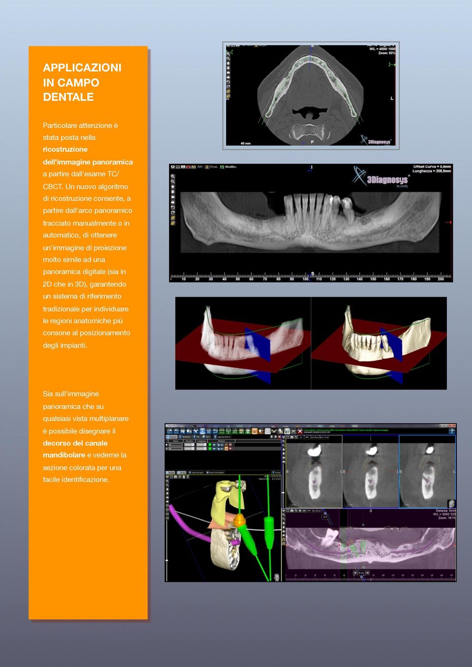 panoramica digitale (sia in 2D che in 3D), garantendo un sistema di riferimento tradizionale per individuare le regioni anatomiche più consone al posizionamento degli