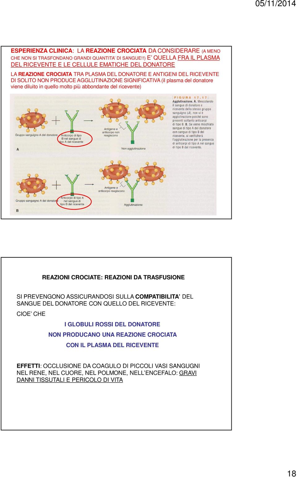 (il plasma del donatore viene diluito in quello molto più abbondante del ricevente) REAZIONI CROCIATE: REAZIONI DA TRASFUSIONE SI PREVENGONO ASSICURANDOSI SULLA COMPATIBILITA DEL SANGUE DEL