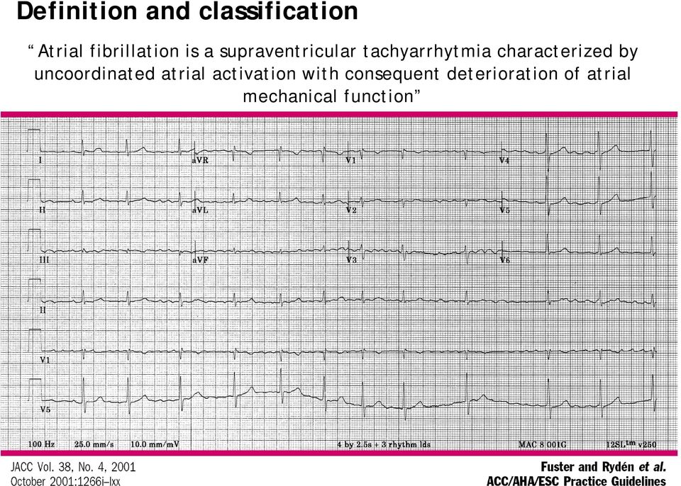 tachyarrhytmia characterized by uncoordinated