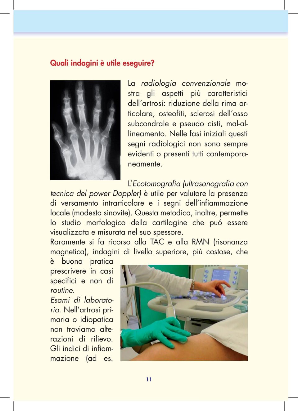 Nelle fasi iniziali questi segni radiologici non sono sempre evidenti o presenti tutti contemporaneamente.