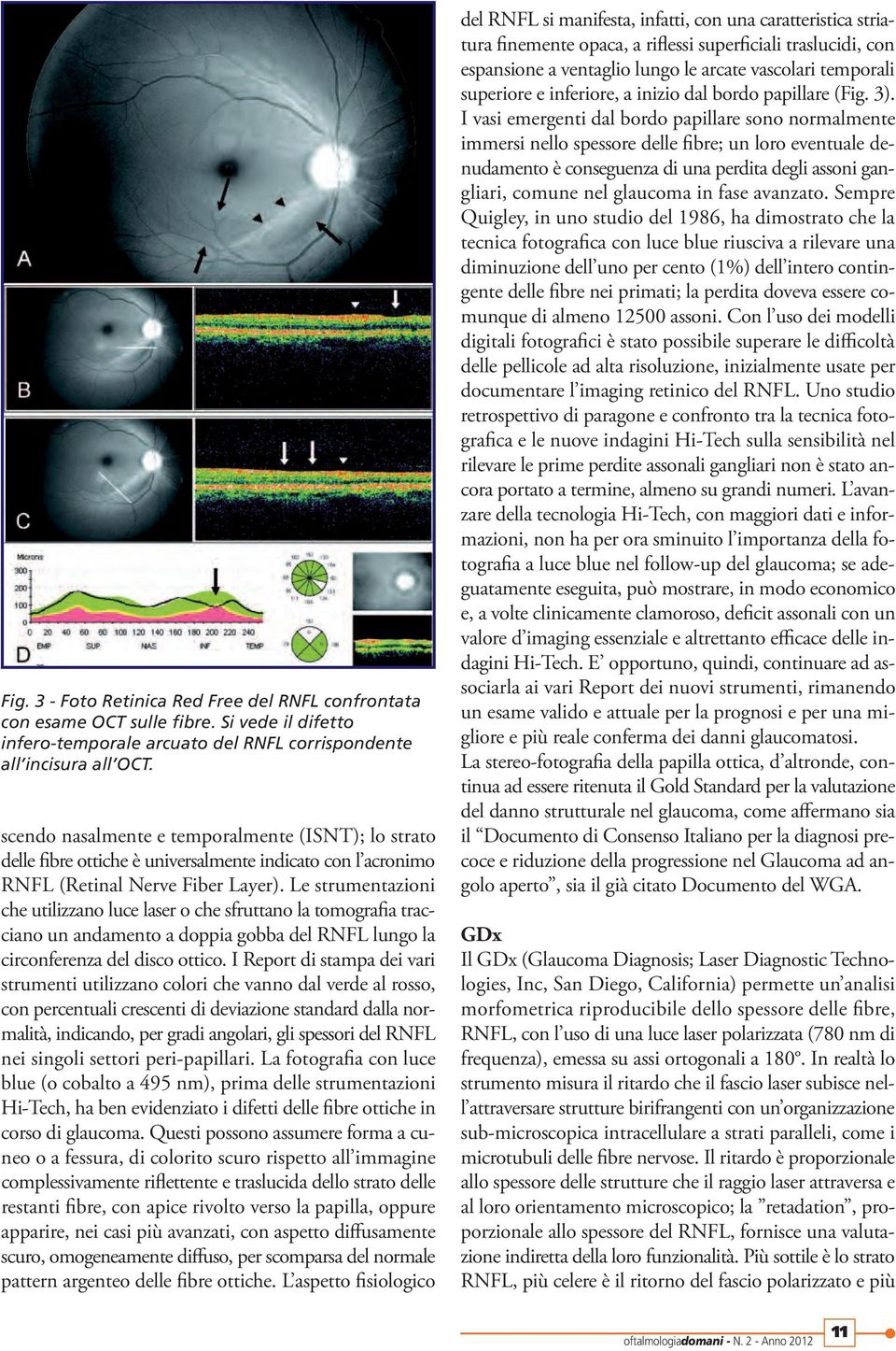 Le strumentazioni che utilizzano luce laser o che sfruttano la tomografia tracciano un andamento a doppia gobba del RNFL lungo la circonferenza del disco ottico.