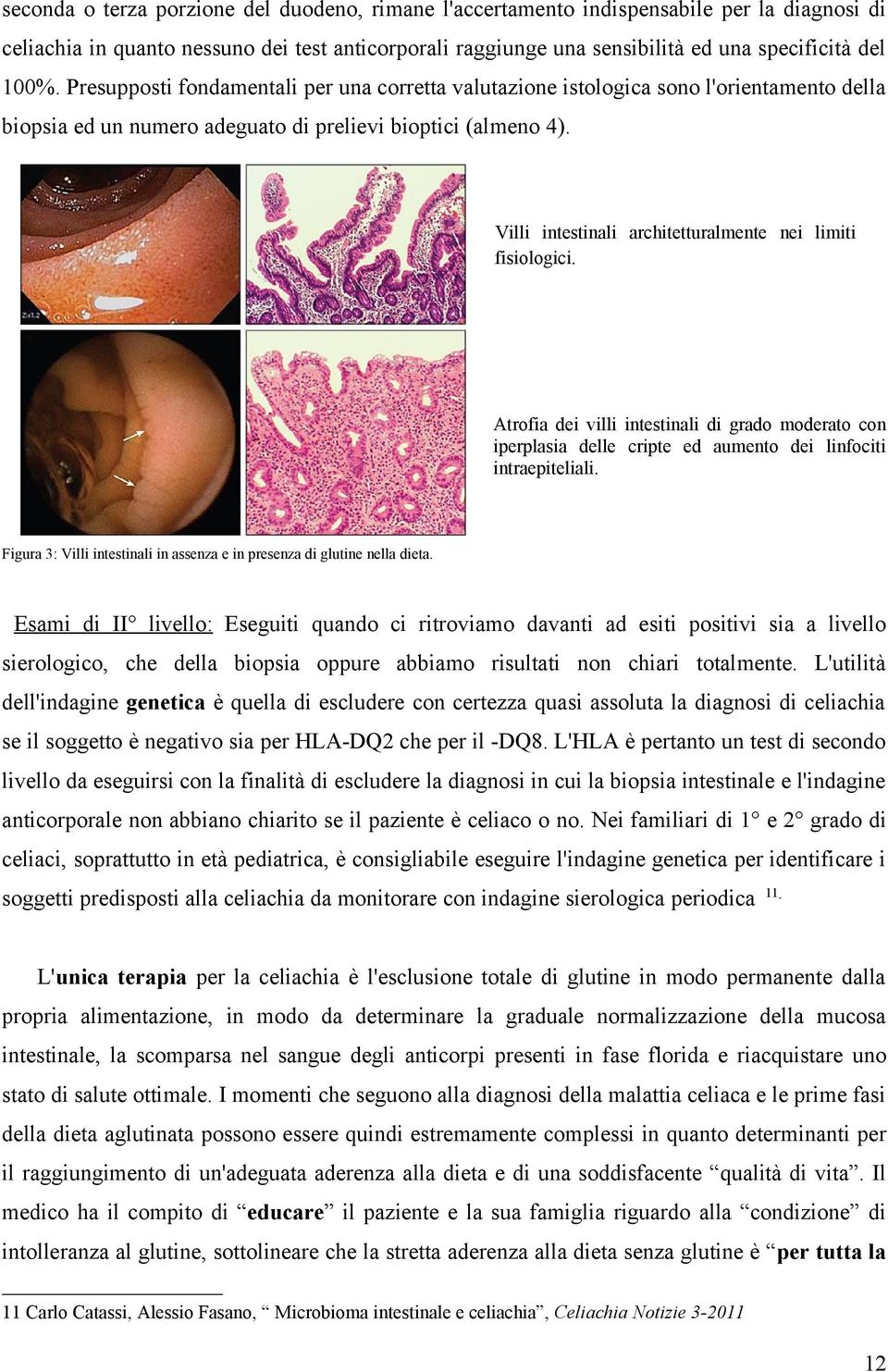 Villi intestinali architetturalmente nei limiti fisiologici. Atrofia dei villi intestinali di grado moderato con iperplasia delle cripte ed aumento dei linfociti intraepiteliali.