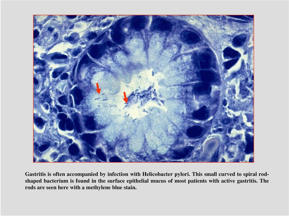 This small curved to spiral rodshaped bacterium is found in