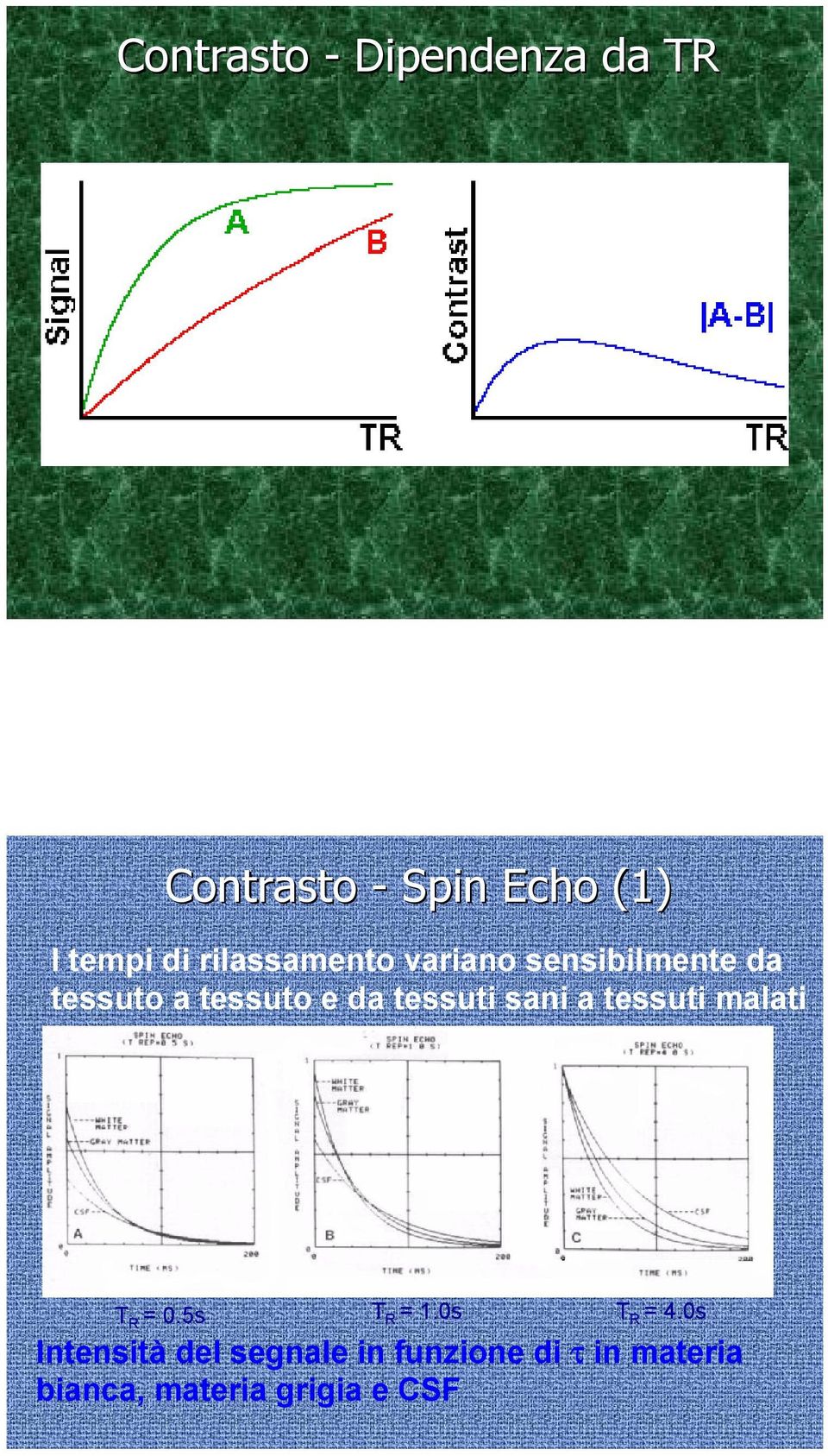 tessuti sani a tessuti malati T R = 0.5s T R = 1.0s T R = 4.