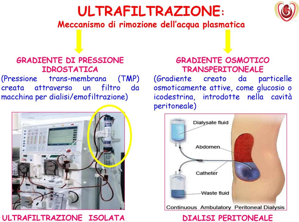 GRADIENTE OSMOTICO TRANSPERITONEALE (Gradiente creato da particelle osmoticamente attive, come