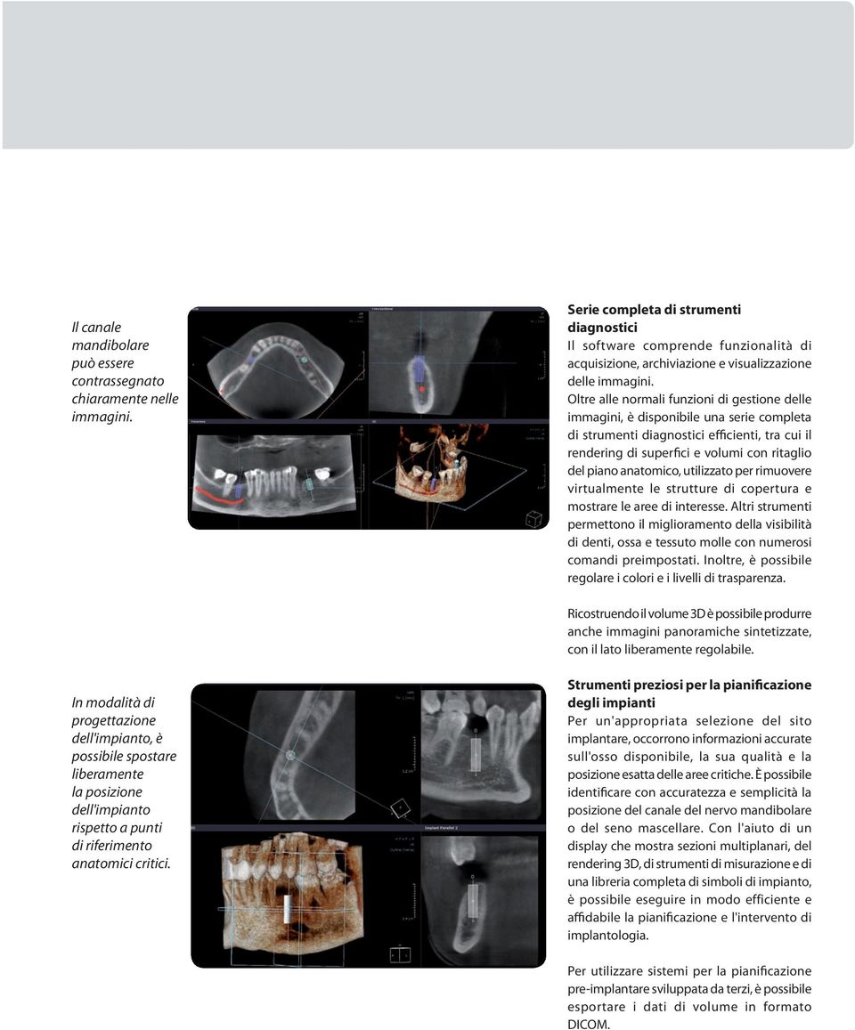 Oltre alle normali funzioni di gestione delle immagini, è disponibile una serie completa di strumenti diagnostici efficienti, tra cui il rendering di superfici e volumi con ritaglio del piano