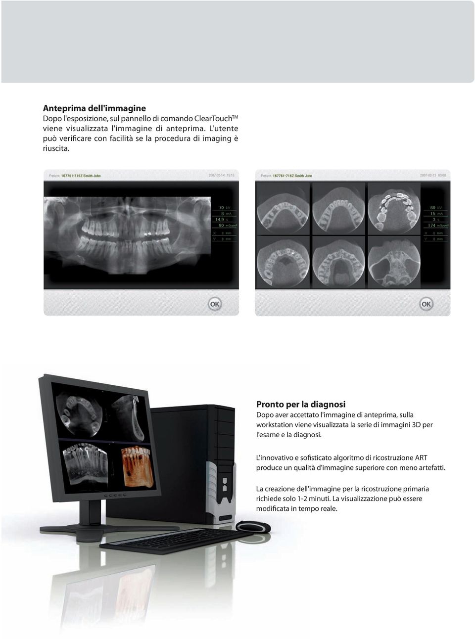 Pronto per la diagnosi Dopo aver accettato l'immagine di anteprima, sulla workstation viene visualizzata la serie di immagini 3D per l'esame e la