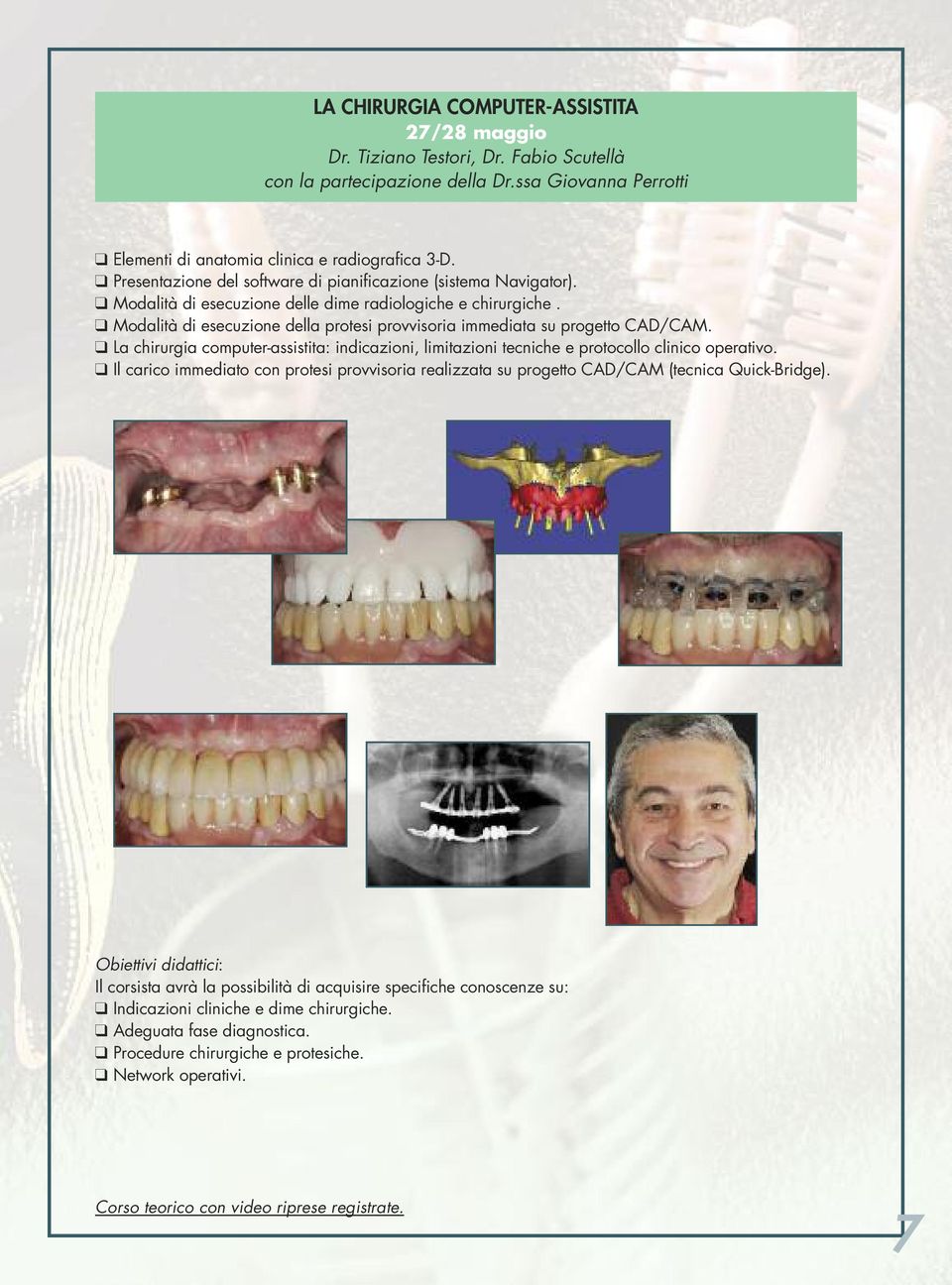 q Modalità di esecuzione della protesi provvisoria immediata su progetto CAD/CAM. q La chirurgia computer-assistita: indicazioni, limitazioni tecniche e protocollo clinico operativo.