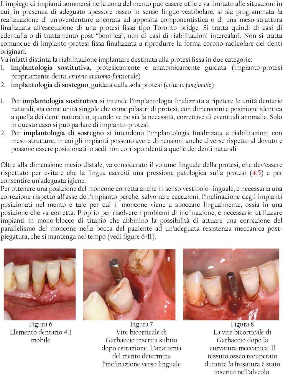 Si tratta quindi di casi di edentulia o di trattamento post bonifica, non di casi di riabilitazioni intercalari.