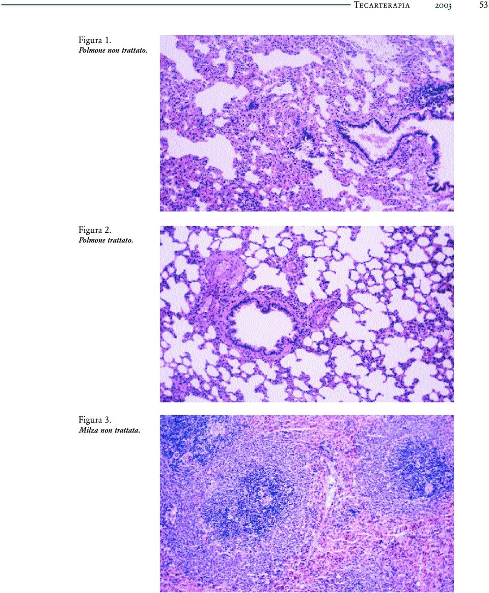 Polmone non trattato.