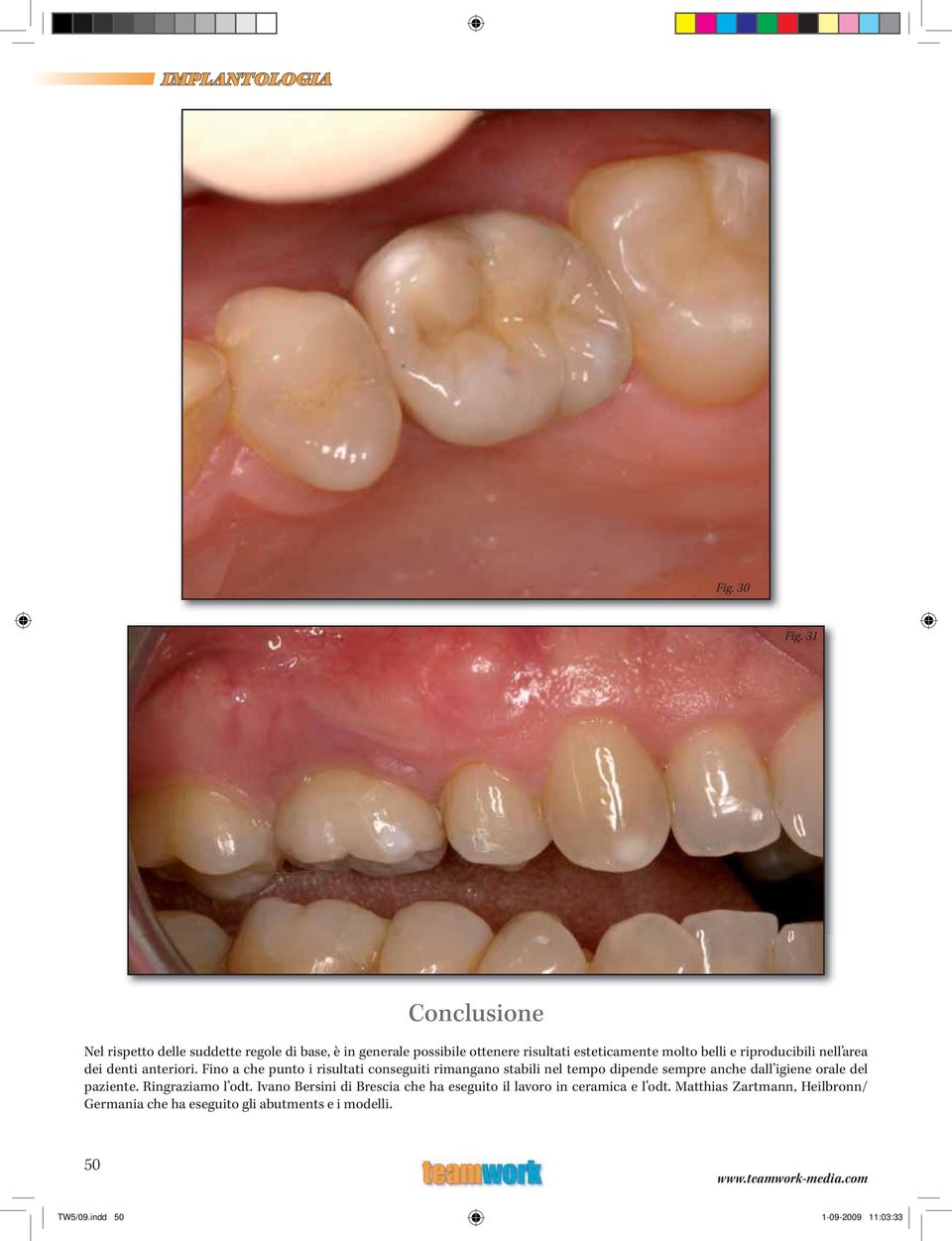 riproducibili nell area dei denti anteriori.