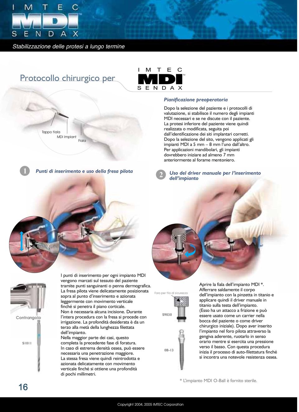 La protesi inferiore del paziente viene quindi realizzata o modificata, seguita poi dall identificazione dei siti implantari corretti.