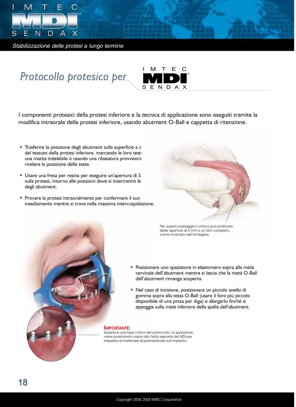 Trasferire la posizione degli abutment sulla superficie a contatto del tessuto della protesi inferiore, marcando le loro teste con una matita indelebile o usando una ribasatura provvisoria per