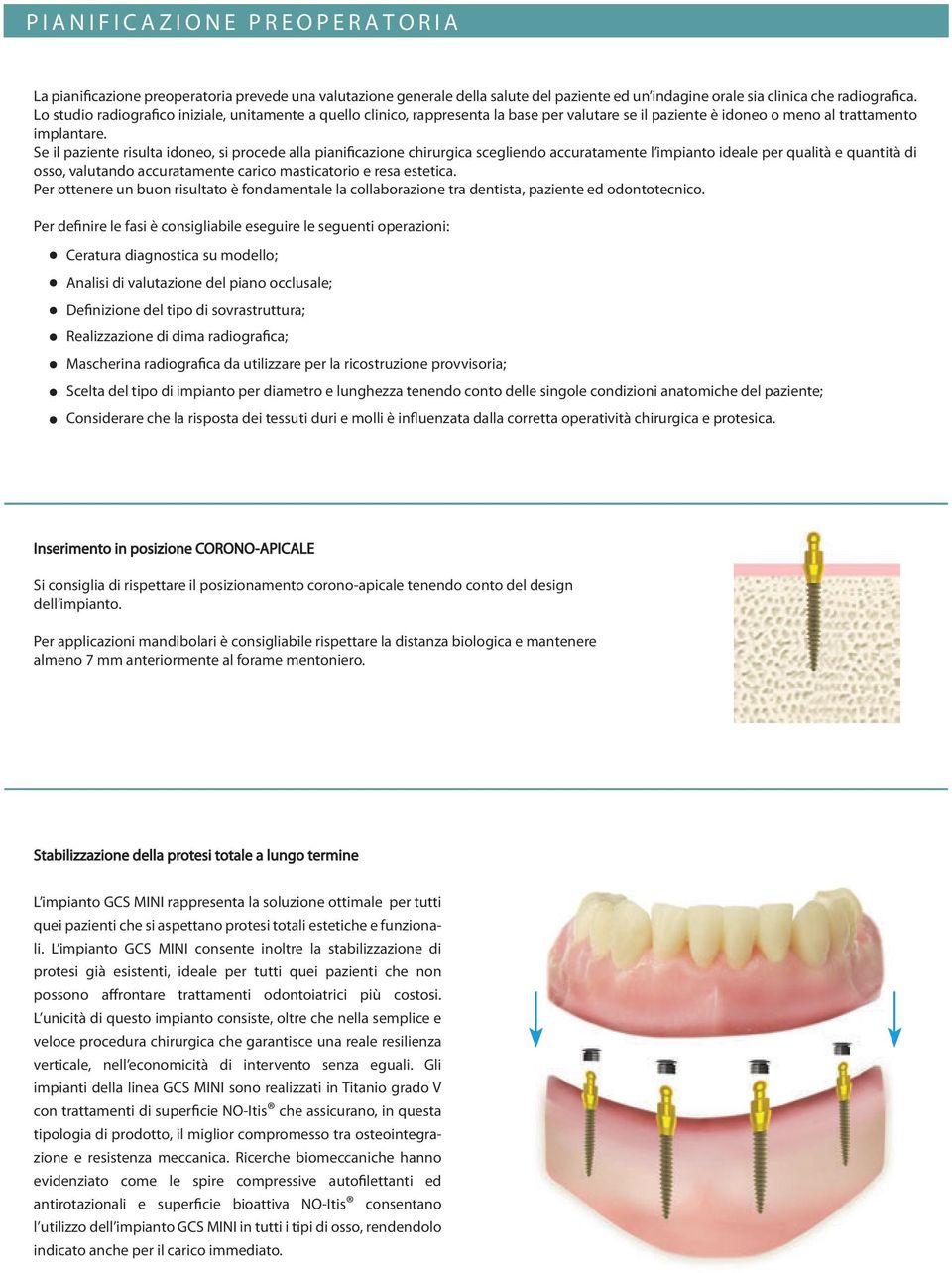 Se il paziente risulta idoneo, si procede alla pianificazione chirurgica scegliendo accuratamente l impianto ideale per qualità e quantità di osso, valutando accuratamente carico masticatorio e resa