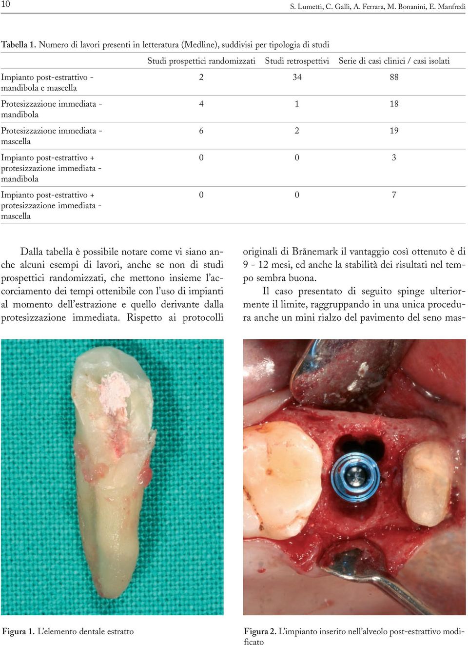 2 34 88 mandibola e mascella Protesizzazione immediata - 4 1 18 mandibola Protesizzazione immediata - 6 2 19 mascella Impianto post-estrattivo + 0 0 3 protesizzazione immediata - mandibola Impianto