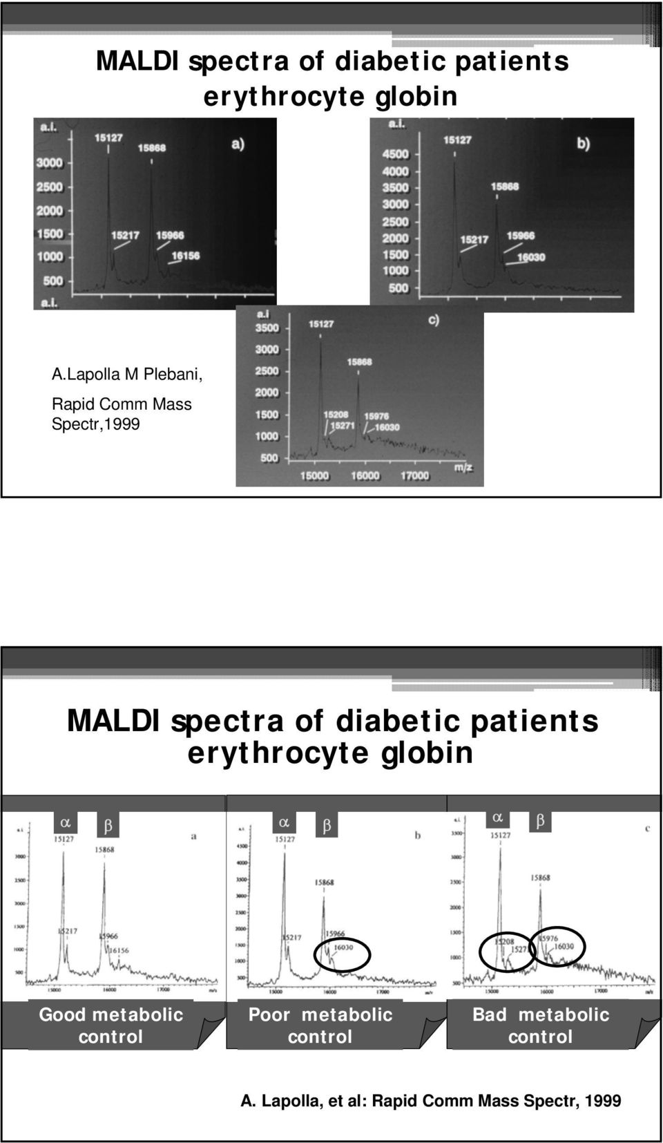 diabetic patients erythrocyte globin α β α β α β Good metabolic