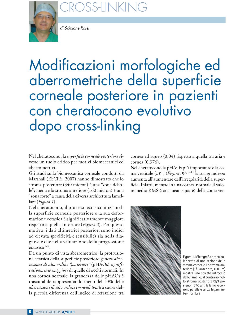 Gli studi sulla biomeccanica corneale condotti da Marshall (ESCRS, 2007) hanno dimostrato che lo stroma posteriore (340 micron) è una zona debole ; mentre lo stroma anteriore (160 micron) è una zona