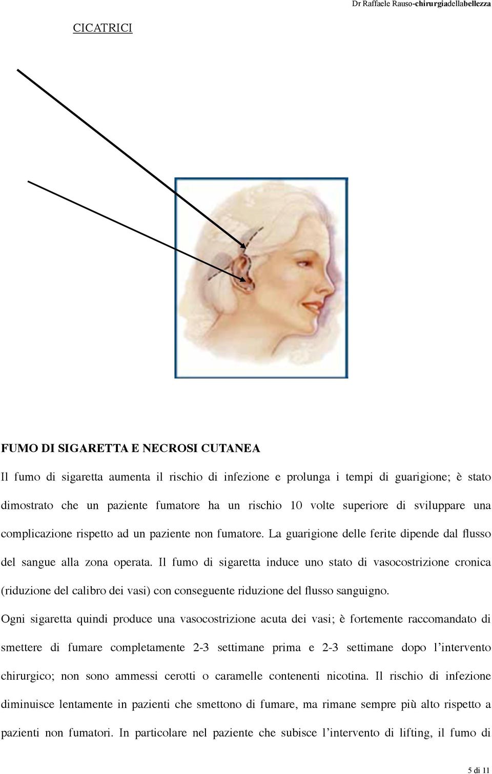 Il fumo di sigaretta induce uno stato di vasocostrizione cronica (riduzione del calibro dei vasi) con conseguente riduzione del flusso sanguigno.